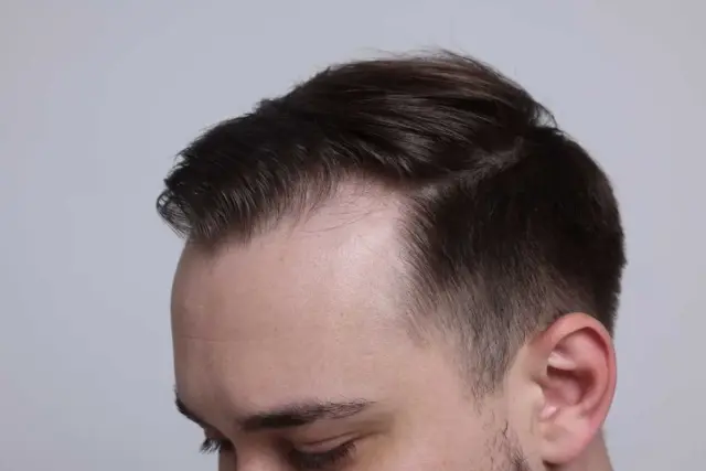 capelli come risolvere problemi